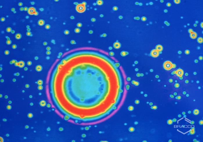 Laboratorio di ricerca del sito Bracco-Sintetica di Battelle (Carouge, Ginevra), dettaglio al microscopio, 1993